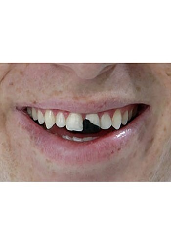 Tooth Wax