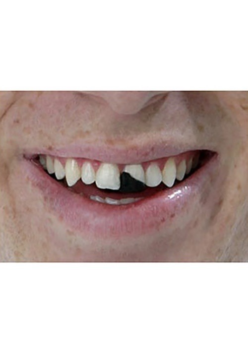 Tooth Wax